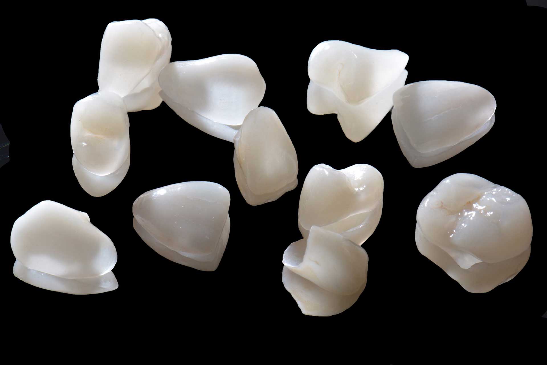Ricostruzione dei denti: meglio in composito o ceramica? Ecco cosa c'è da  sapere