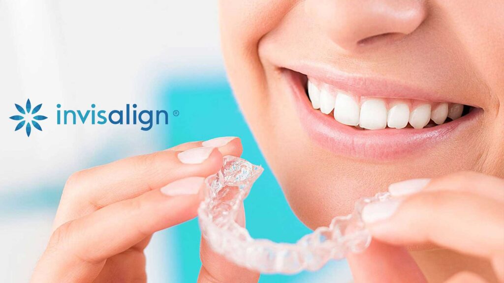 invisalign roma